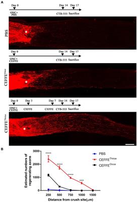 Cell-free fat extract promotes axon regeneration and retinal ganglion cells survival in traumatic optic neuropathy